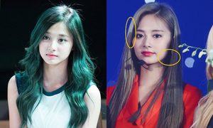 How Has Twice Tzuyu S Face Changed After Wearing Braces Kbizoom
